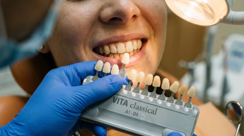 ¿Qué es un mapa cromático dental?